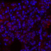 Immunofluorescence analysis of Rat lung tissue using GLUT-1 Polyclonal Antibody at dilution of 1:200.