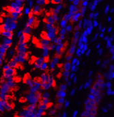 Immunofluorescence analysis of Rat lung tissue using MMP2 Polyclonal Antibody at dilution of 1:200.