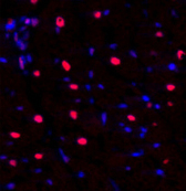 Immunofluorescence analysis of Rat heart tissue using NFκB-p105/p50 Polyclonal Antibody at dilution of 1:200.