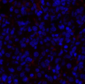 Immunofluorescence analysis of Rat lung tissue using PDPK1 Polyclonal Antibody at dilution of 1:200.