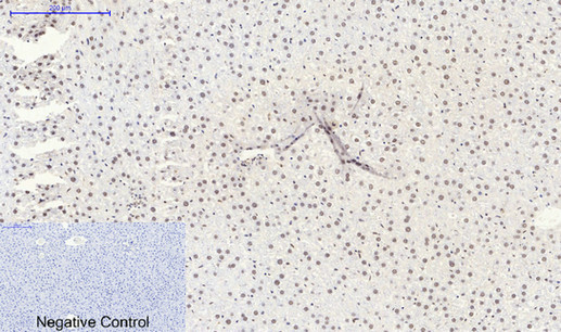 Immunohistochemistry of paraffin-embedded Rat liver tissue using SIRT1 Polyclonal Antibody at dilution of 1:200.