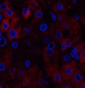 Immunofluorescence analysis of Human liver tissue using Stat1 Polyclonal Antibody at dilution of 1:200.