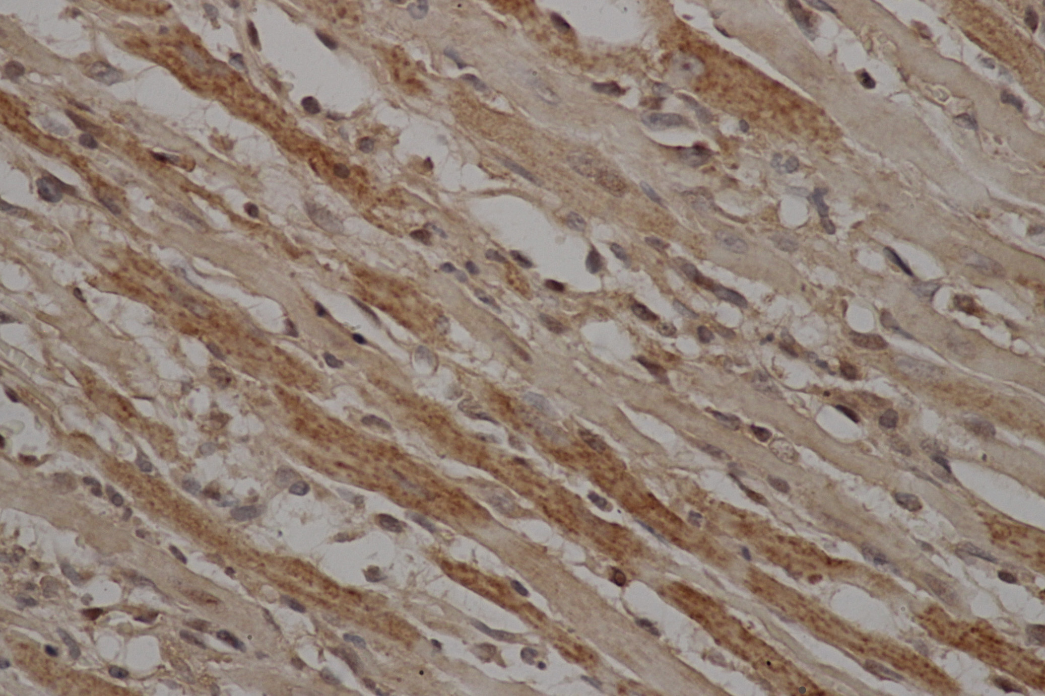 Immunohistochemistry of paraffin-embedded Mouse heart using Stat3 antibody at dilution of 1:50