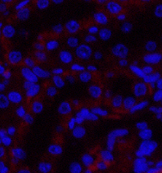 Immunofluorescence analysis of Rat kidney tissue using JAK3 Polyclonal Antibody at dilution of 1:200.