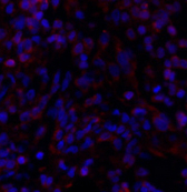 Immunofluorescence analysis of Rat lung tissue using Smad4 Polyclonal Antibody at dilution of 1:200.