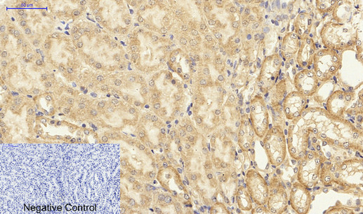 Immunohistochemistry of paraffin-embedded Mouse kidney tissue using NFκB-p65 Polyclonal Antibody at dilution of 1:200.