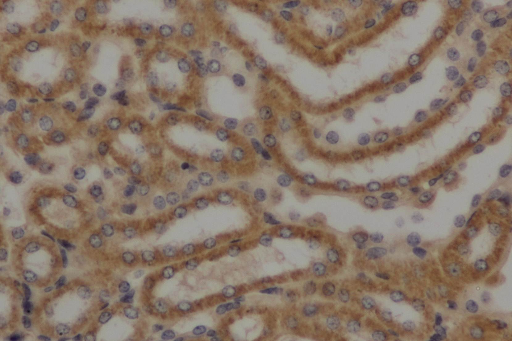 Immunohistochemistry of paraffin-embedded Mouse kidney using AFP Polyclonal Antibody at dilution of 1:50