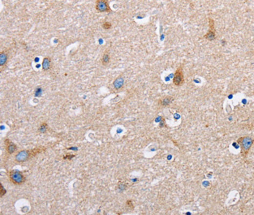 Immunohistochemistry of paraffin-embedded Human brain tissue using FN1 Polyclonal Antibody at dilution 1:50