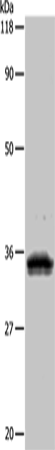 Western Blot analysis of 293T cell using UPK3B Polyclonal Antibody at dilution of 1:1000