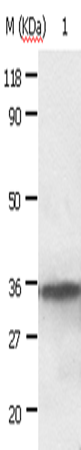 Western Blot analysis of HepG2 cell using ANXA2 Polyclonal Antibody at dilution of 1:640