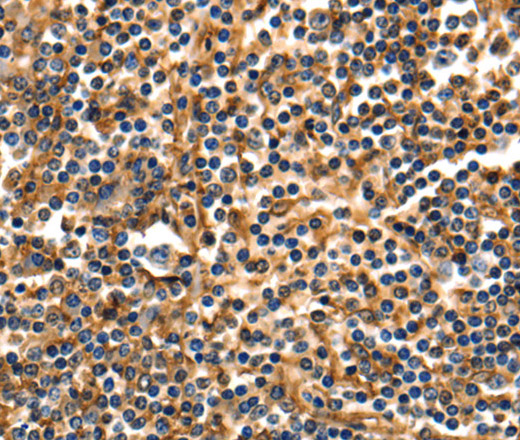 Immunohistochemistry of paraffin-embedded Human tonsil using ANXA5 Polyclonal Antibody at dilution of 1:40