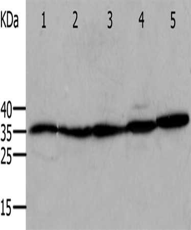 Western Blot analysis of Mouse eyes and heart, Human cervical cancer tissue, OP9 and RAW264.7 cell using ANXA5 Polyclonal Antibody at dilution of 1:750