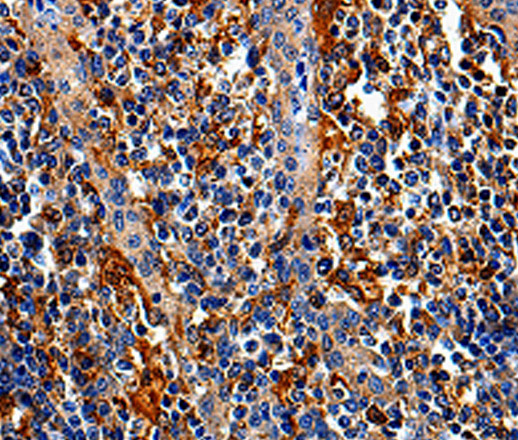 Immunohistochemistry of paraffin-embedded Human tonsil tissue using COX16 Polyclonal Antibody at dilution 1:50