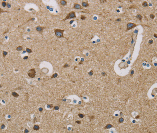 Immunohistochemistry of paraffin-embedded Human brain  using COX6B1 Polyclonal Antibody at dilution of 1:50