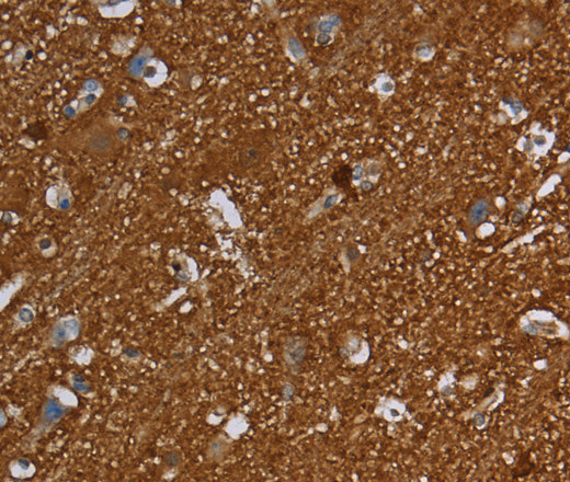 Immunohistochemistry of paraffin-embedded Human brain using SNCG Polyclonal Antibody at dilution of 1:60