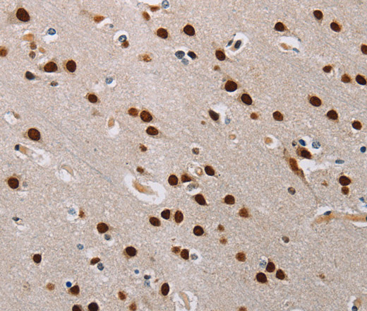 Immunohistochemistry of paraffin-embedded Human brain  tissue using TONSL Polyclonal Antibody at dilution 1:60