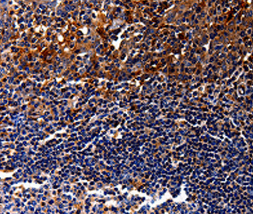 Immunohistochemistry of paraffin-embedded Human tonsil tissue using IL10RA Polyclonal Antibody at dilution 1:30