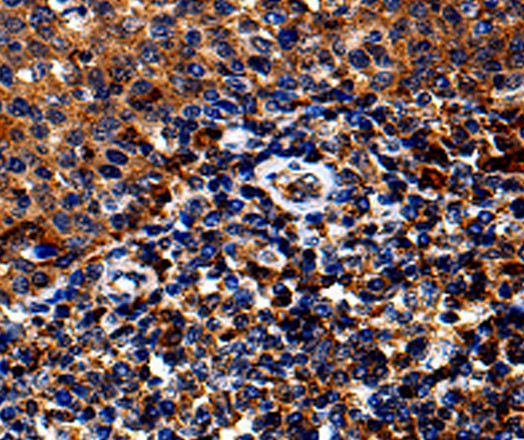 Immunohistochemistry of paraffin-embedded Human tosil tissue using IL13RA1 Polyclonal Antibody at dilution 1:50