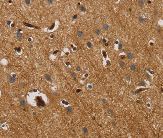 Immunohistochemistry of paraffin-embedded Human brain  tissue using IL18R1 Polyclonal Antibody at dilution 1:40