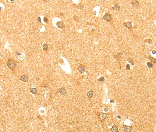 Immunohistochemistry of paraffin-embedded Human brain  using AARS2 Polyclonal Antibody at dilution of 1:40