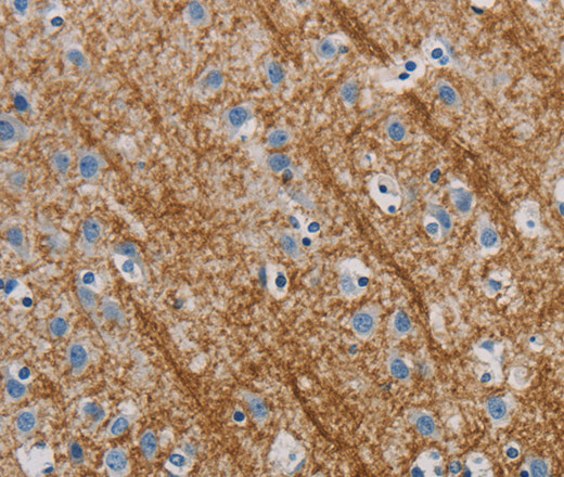 Immunohistochemistry of paraffin-embedded Human brain tissue using ABL1 Polyclonal Antibody at dilution 1:40