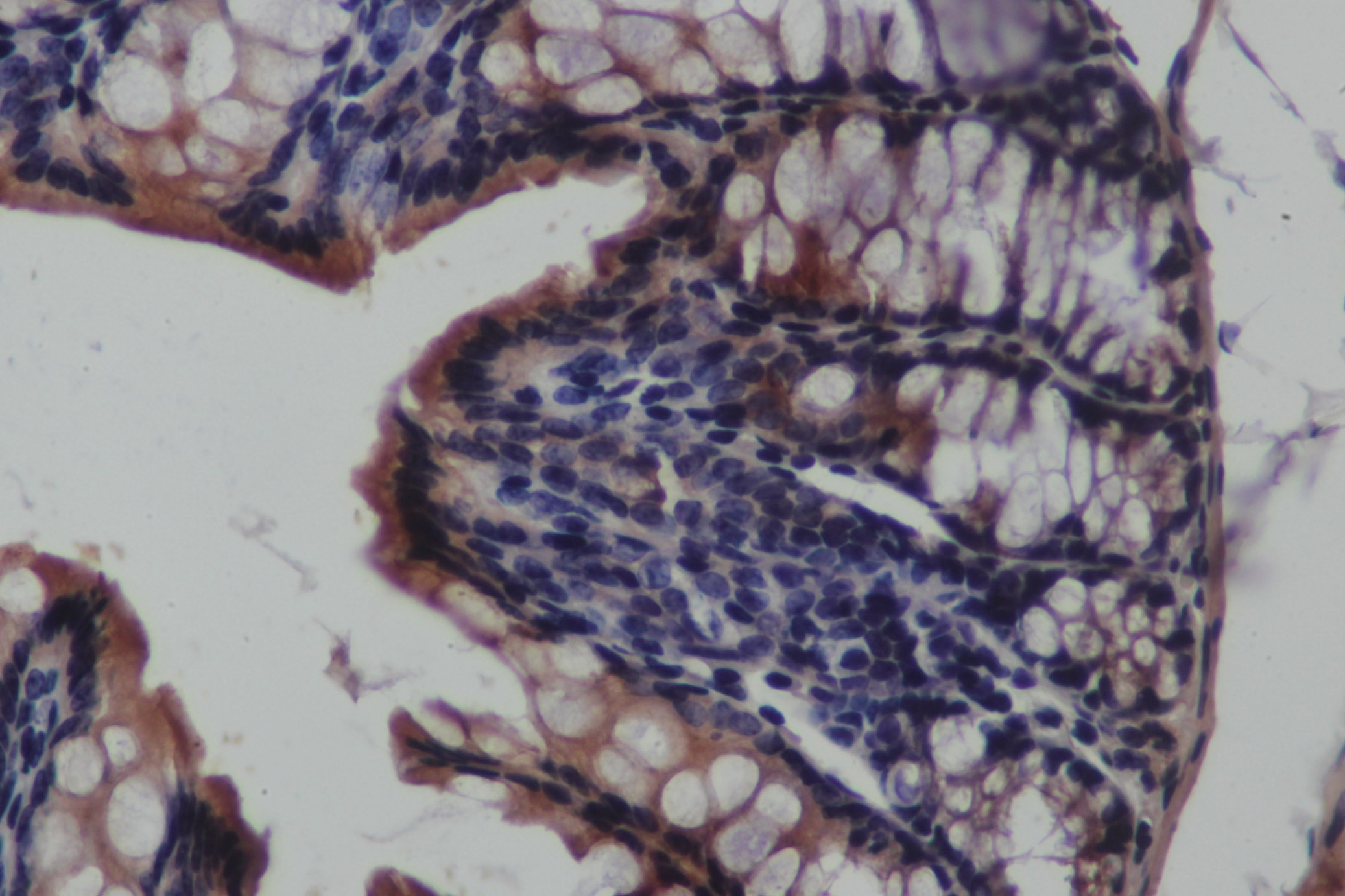 Immunohistochemistry of paraffin-embedded Rat colon using CK-19 Polyclonal Antibody at dilution of 1:50