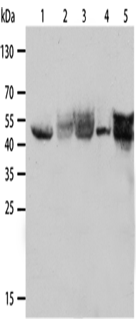 Western Blot analysis of A431, Hela and Lovo cell, Human fetal lung and adult liver tissue using CK-19 Polyclonal Antibody at dilution of 1:1000