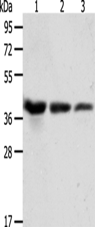 Western Blot analysis of A431, Hela and Raji cell using ANXA1 Polyclonal Antibody at dilution of 1:450