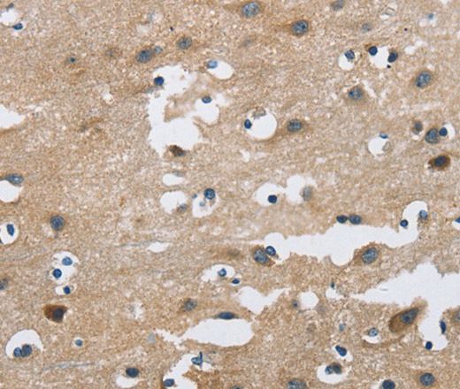 Immunohistochemistry of paraffin-embedded Human brain  using FGF9 Polyclonal Antibody at dilution of 1:40
