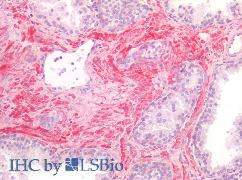 Immunohistochemistry of paraffin-embedded Human Smooth Muscle using BMP4 Polyclonal Antibody at dilution of 1:70.