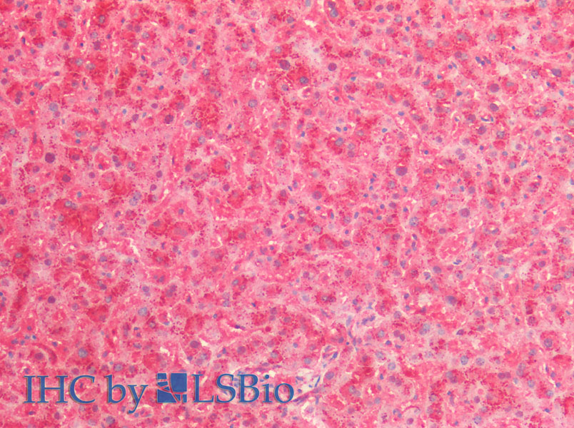 Immunohistochemistry of paraffin-embedded Human Liver using Cathepsin B Polyclonal Antibody at dilution of 1:80.