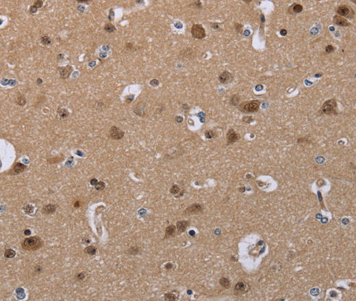 Immunohistochemistry of paraffin-embedded Human brain  using CDK5 Polyclonal Antibody at dilution of 1:30