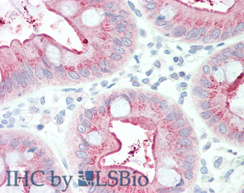 Immunohistochemistry of paraffin-embedded Human Colon tissue using CEACAM8 Polyclonal Antibody at dilution of 1:100.