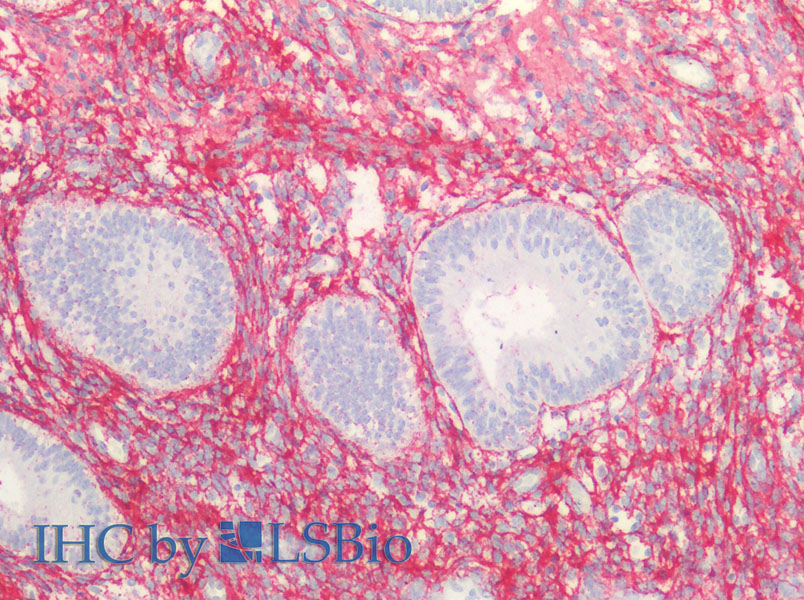 Immunohistochemistry of paraffin-embedded Human endometrium and prostate using COL3A1 Polyclonal Antibody at dilution of 1:100.