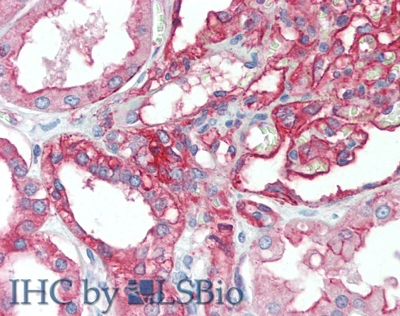 Immunohistochemistry of paraffin-embedded Kidney tissue using CD151 Polyclonal Antibody at dilution of 1:120.