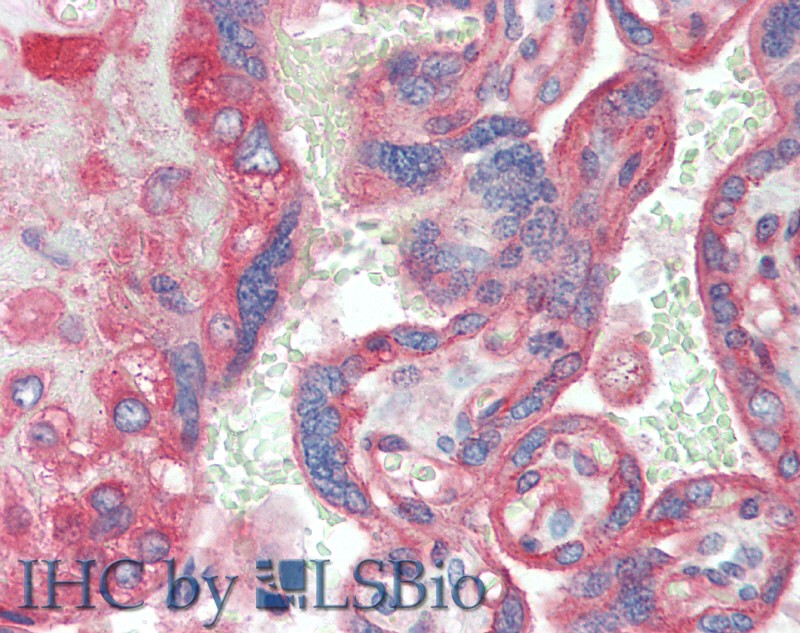 Immunohistochemistry of paraffin-embedded Placenta tissue using CD151 Polyclonal Antibody at dilution of 1:120.