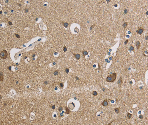 Immunohistochemistry of paraffin-embedded Human brain  using CYCS Polyclonal Antibody at dilution of 1:50
