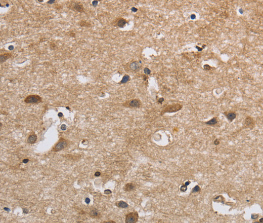 Immunohistochemistry of paraffin-embedded Human brain  using SDCCAG3 Polyclonal Antibody at dilution of 1:30