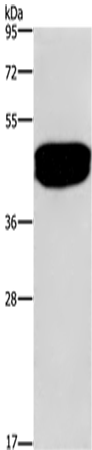 Western Blot analysis of Human prostate tissue using SDCCAG3 Polyclonal Antibody at dilution of 1:500