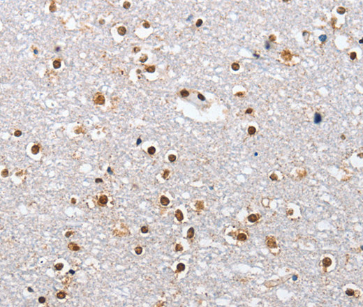 Immunohistochemistry of paraffin-embedded Human brain  using ELAVL1 Polyclonal Antibody at dilution of 1:40