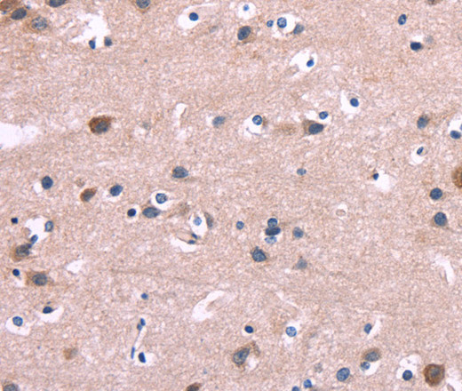 Immunohistochemistry of paraffin-embedded Human brain  tissue using DUSP13 Polyclonal Antibody at dilution 1:60