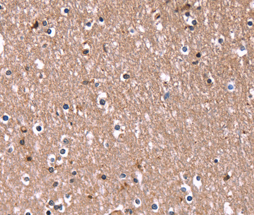 Immunohistochemistry of paraffin-embedded Human brain  using RDX Polyclonal Antibody at dilution of 1:60