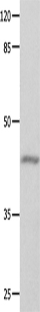 Western Blot analysis of Mouse eyes tissue using GNA11 Polyclonal Antibody at dilution of 1:550