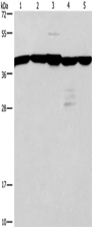 Western Blot analysis of A172 and 293T cell, Mouse kidney tissue, Human testis and brain malignant glioma tissue using GNA13 Polyclonal Antibody at dilution of 1:600