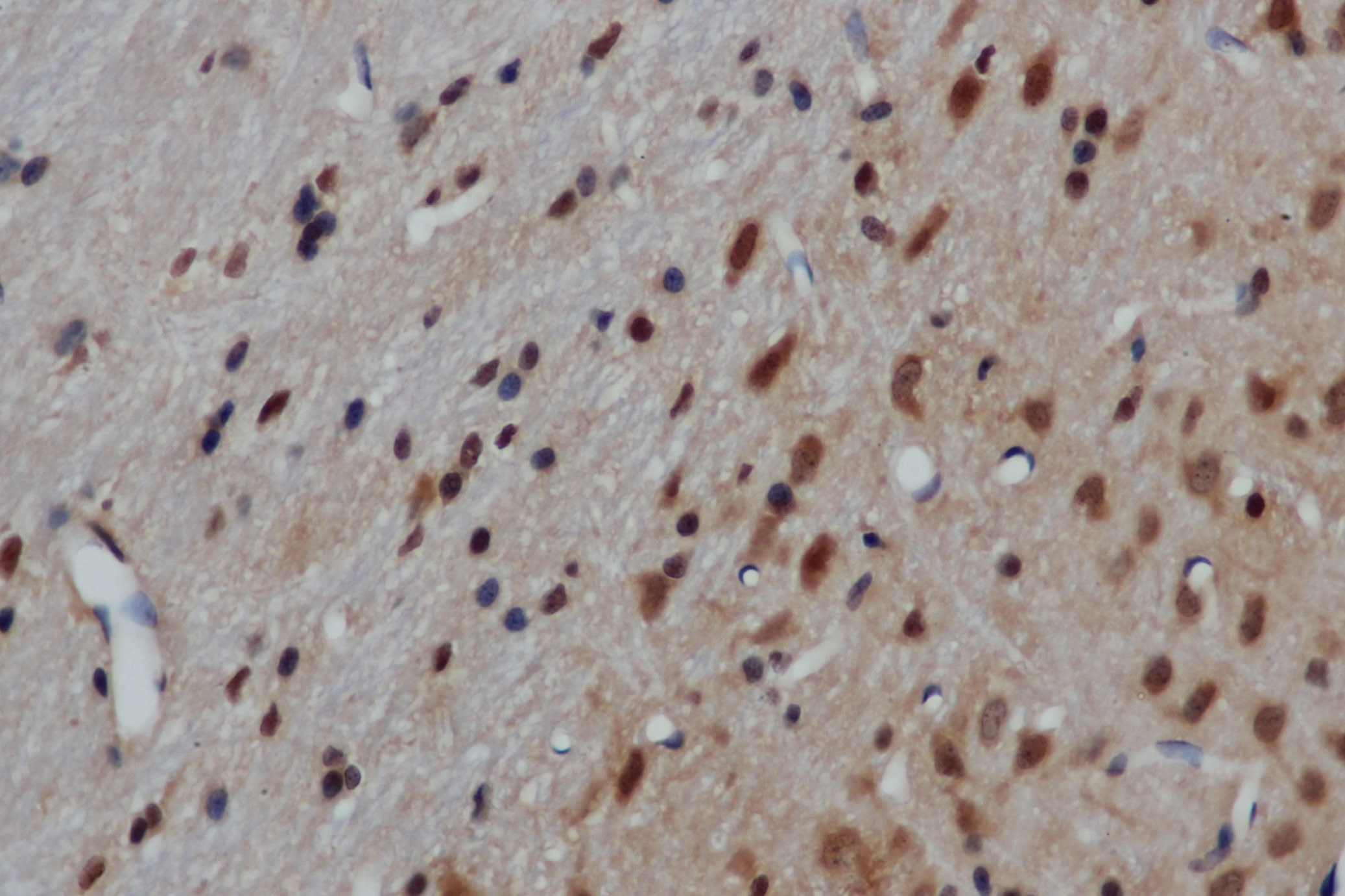 Immunohistochemistry of paraffin-embedded Mouse brain using GRP Polyclonal Antibody at dilution of 1:50