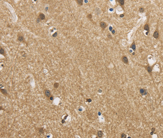 Immunohistochemistry of paraffin-embedded Human brain  using GAS7 Polyclonal Antibody at dilution of 1:50