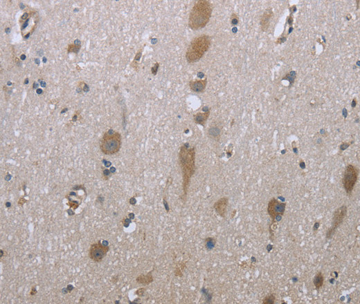 Immunohistochemistry of paraffin-embedded Human brain tissue using GPC6 Polyclonal Antibody at dilution 1:40