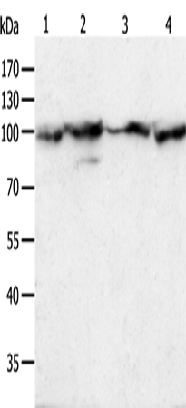 Western Blot analysis of Hela cell and Human liver cancer tissue, Jurkat and NIH/3T3 cell using HSP90B1 Polyclonal Antibody at dilution of 1:500