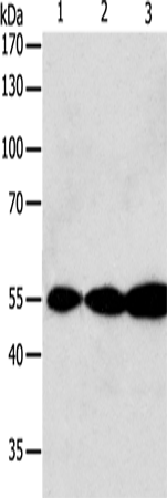 Western Blot analysis of Jurkat, Hela and A549 cell using GSR Polyclonal Antibody at dilution of 1:750