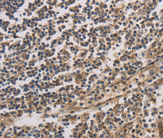 Immunohistochemistry of paraffin-embedded Human tonsil tissue using HSF1 Polyclonal Antibody at dilution 1:60